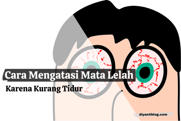 Cara Mengatasi Mata Lelah Karena Kurang Tidur Akibat Sering Begadang ...