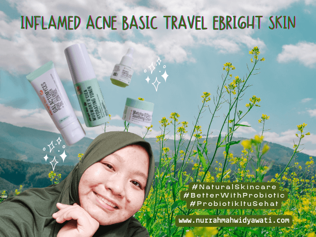 Basic Skincare Untuk Kulit Sensitif Dan Bruntusan